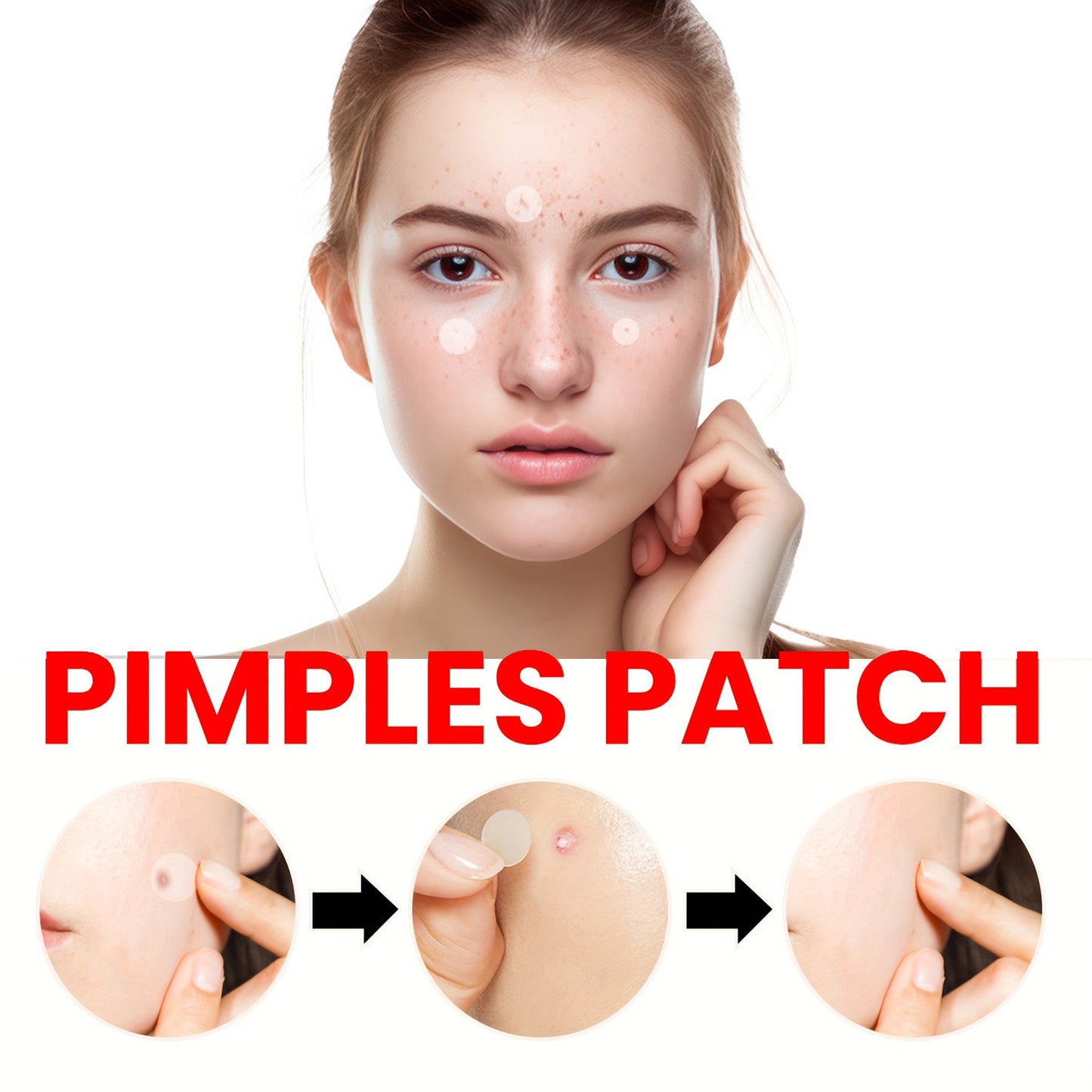 iBeaLee 1080pcs Hydrocolloid Acne Pimple Patch - Tea Tree Oil Infused, Waterproof Blemish Cover Stickers for All Skin Types, Unisex Adult, Formaldehyde-Free, Day & Night Use