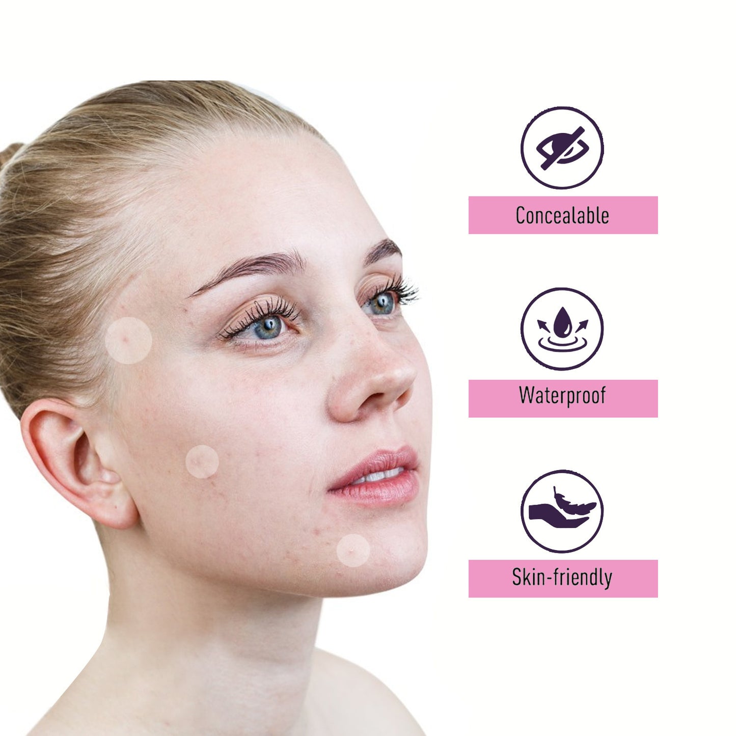 iBeaLee 1080pcs Hydrocolloid Acne Pimple Patch - Tea Tree Oil Infused, Waterproof Blemish Cover Stickers for All Skin Types, Unisex Adult, Formaldehyde-Free, Day & Night Use
